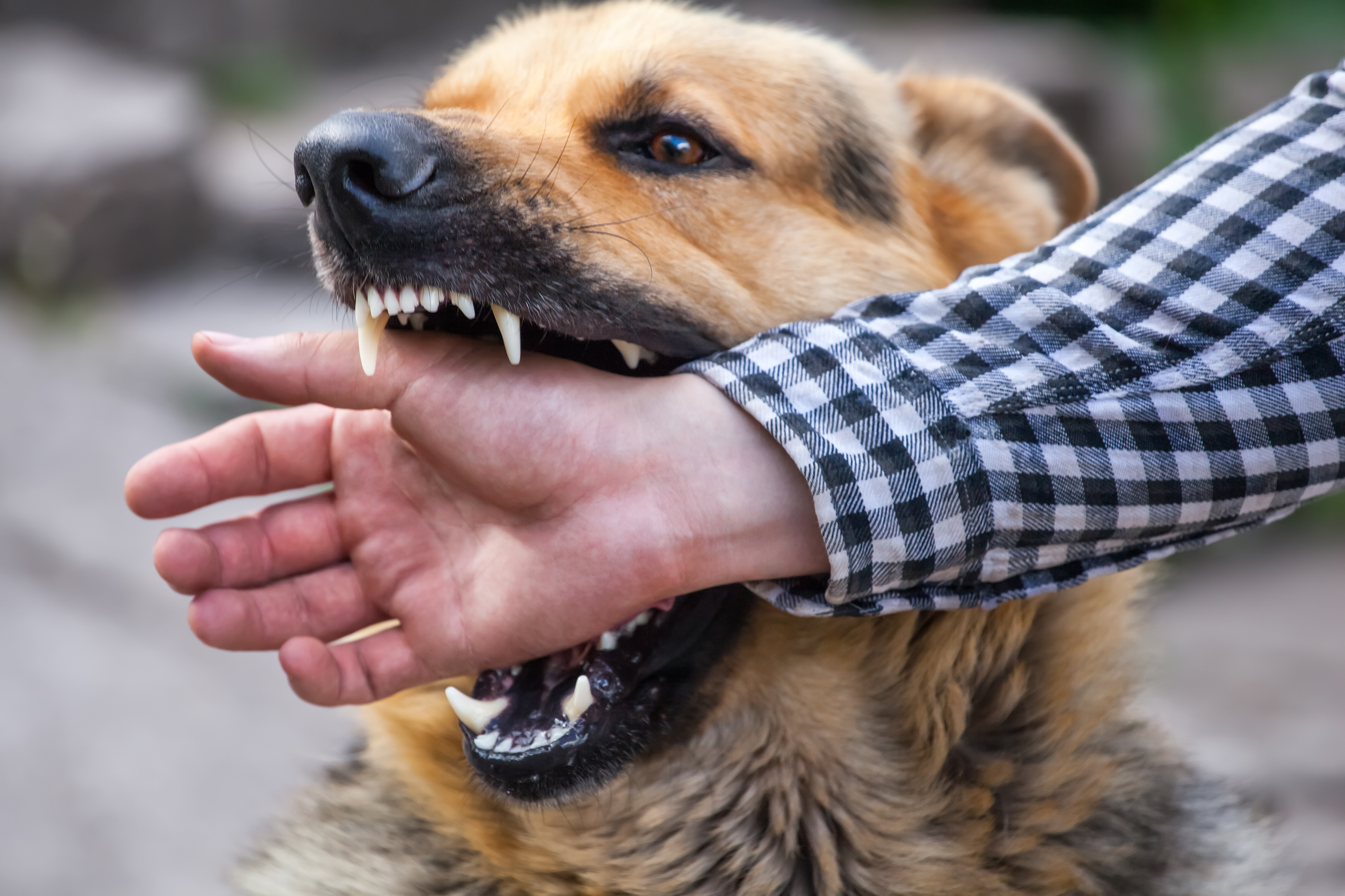 Common Injuries Sustained From a Dog Attack